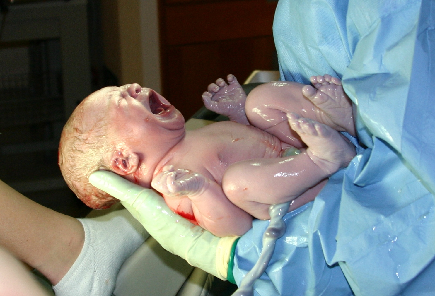 Nyfødt med tilsynelatende god Apgar-skår! Illustrasjonfoto: Wikimedia Commons