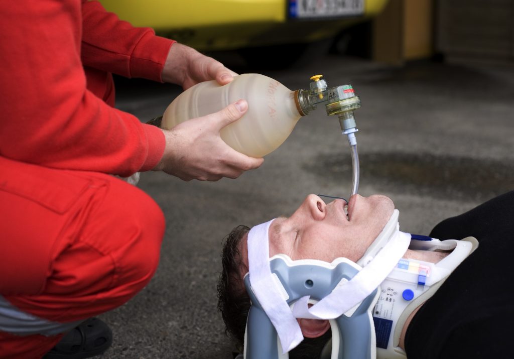 Ambulansepersonell vil som hovedregel ikke lenger kunne endotrakealintubere. Foto: Therese B. Kirkesæther